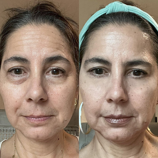 Parches Mágicos (30 Pares) | Difumina Ojeras y Bolsas en los Ojos