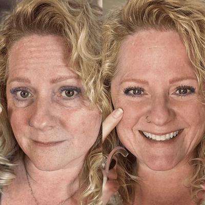 Parches Mágicos (30 Pares) | Difumina Ojeras y Bolsas en los Ojos