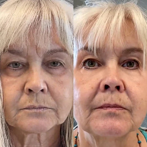 Parches Mágicos (30 Pares) | Difumina Ojeras y Bolsas en los Ojos