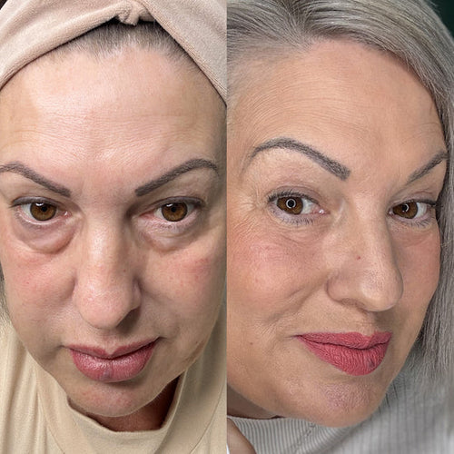 Parches Mágicos (30 Pares) | Difumina Ojeras y Bolsas en los Ojos